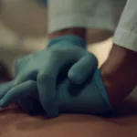 Reanimación Cardiopulmonar (RCP)